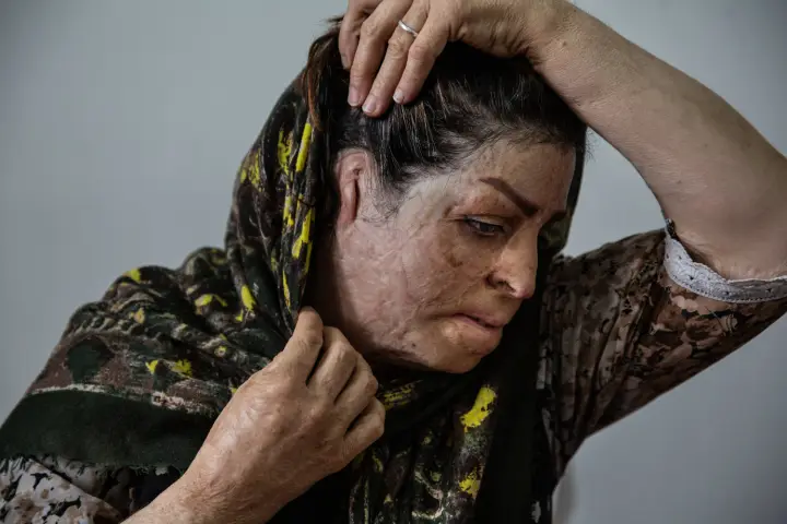 Self-immolation among the Kurdish Women